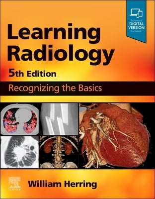 Learning Radiology: Recognizing the Basics by Herring, William